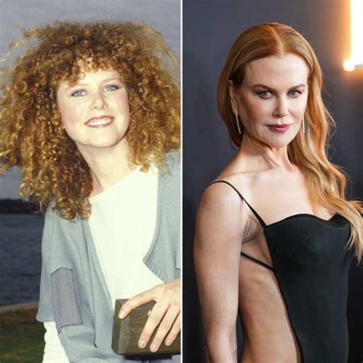 Unveiling Truths: Is Nicole Kidman Expecting?